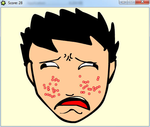 ZIT POPPING FAIL.png
