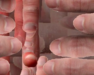itchThumb.png